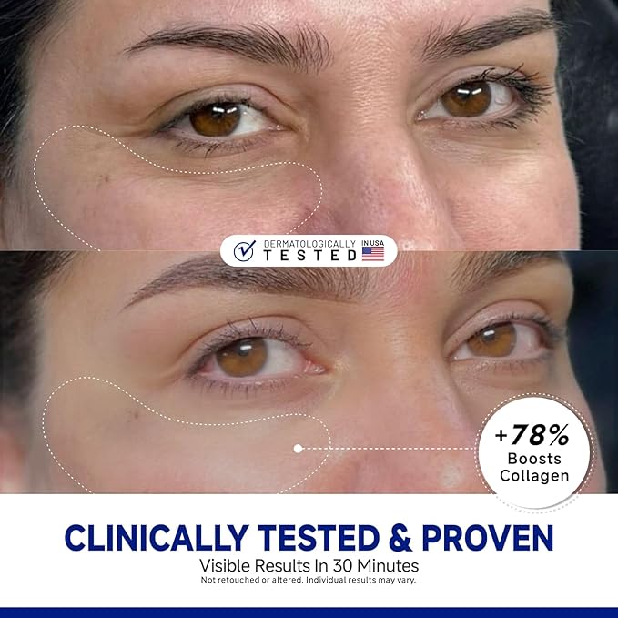 Peptide Under Eye Patches, Firming Eye Patches Instant Reduces Dark Circles and Puffiness, Collagen Under Eye Mask for Bags Treatment, Wrinkles, 60 Pairs, Vegan