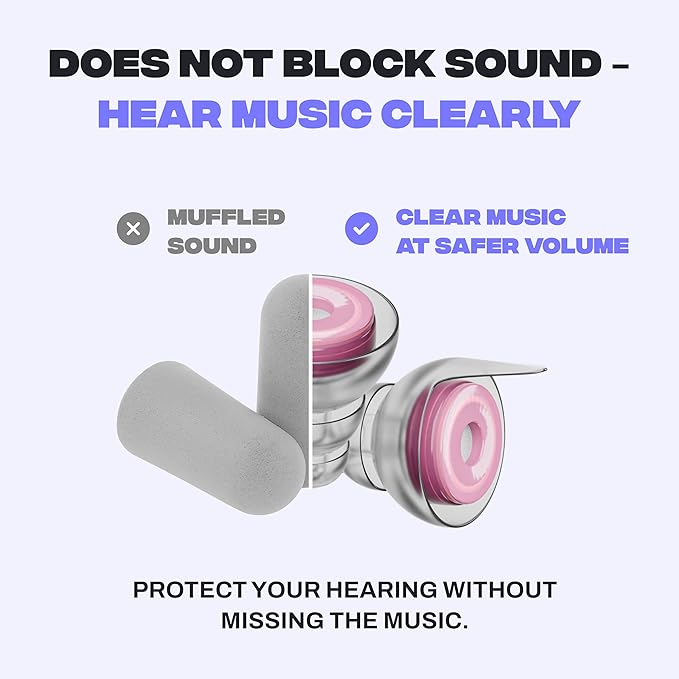 Zound Concert Earplugs Cosmic Blush - Reduces Loud Noise But Does Not Muffle Sound, Hear Music Clearly & Safely at Concerts & Festivals - Reusable, Comfortable Hearing Protection with Case