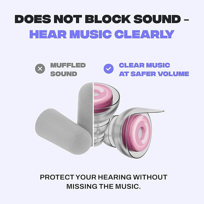 Zound Concert Earplugs Cosmic Blush - Reduces Loud Noise But Does Not Muffle Sound, Hear Music Clearly & Safely at Concerts & Festivals - Reusable, Comfortable Hearing Protection with Case