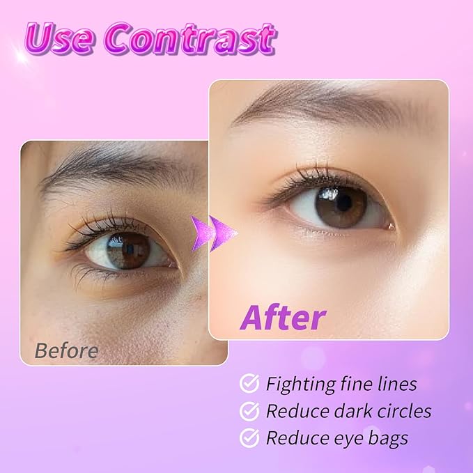 Eye Masks (24 Pairs) - Gift for Her - Tri-color Under Eye Patches for Dark Circles, Puffiness, Wrinkles, Soothing & Hydrating, Skincare Eye Gel Pads, Beauty Essential for Women, Valentines Gift